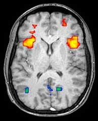 FMRI Brain Scanning